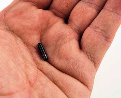 tout votre dossier médical implanté dans votre corps dans une puce de la taille