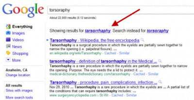 les résultat de la requête 'tarsorrhaphie' tapée dans google.