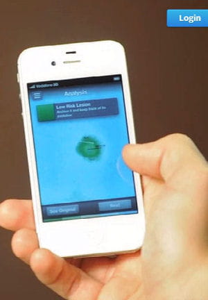 skinvision permet de détecter le plus tôt possible les mélanomes.