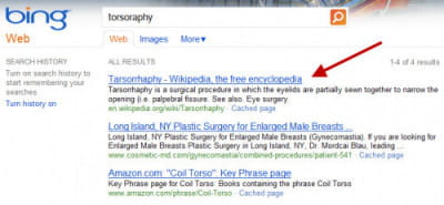 les résultats de la même requête mal ortographiée sont identiques chez bing.