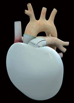 le coeur artificiel de carmat est conçu pour s'autoréguler.