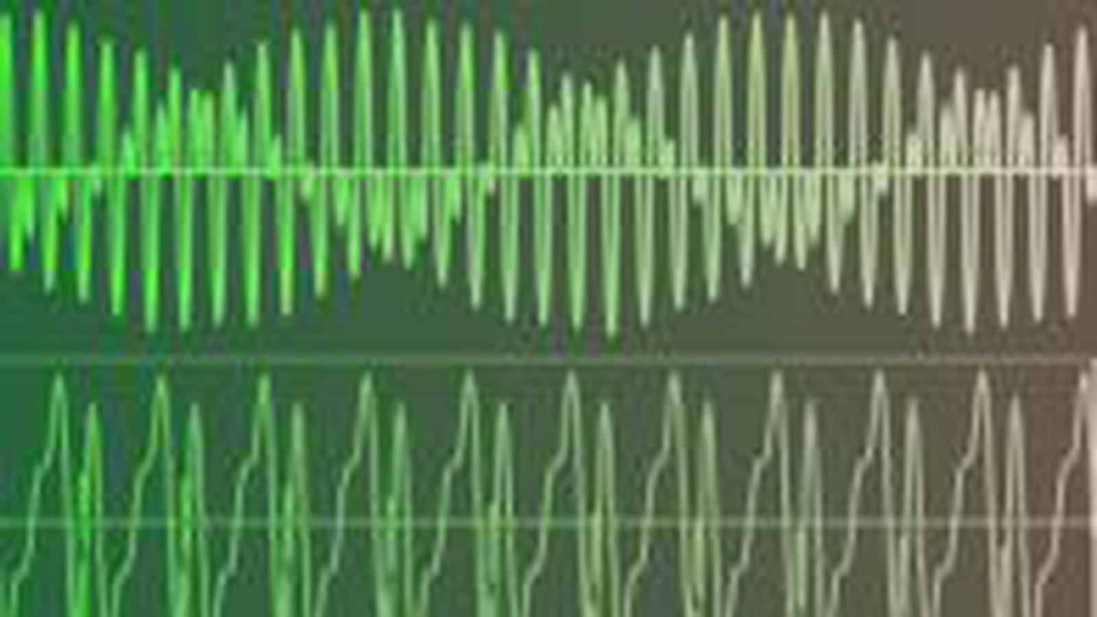 Ondes radio