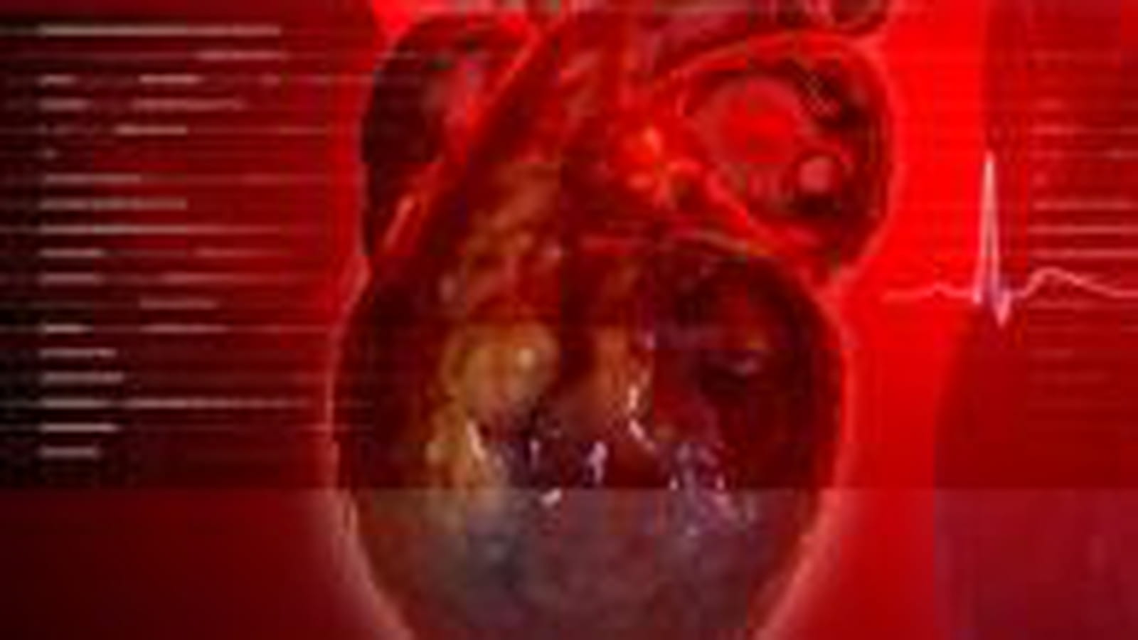 Cell Prothéra