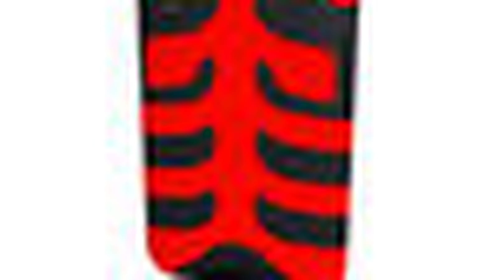 Etui de protection 