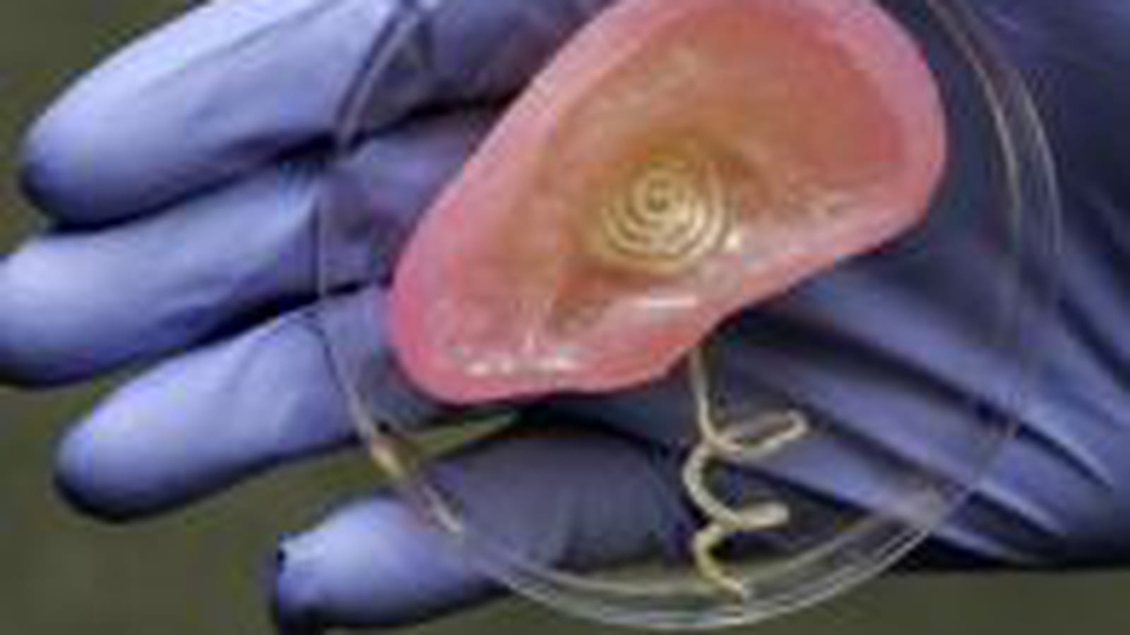 Oreille bionique